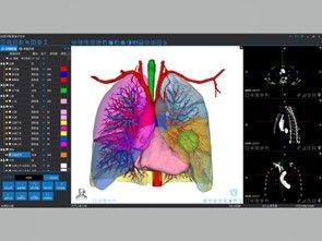 Medische 3D-reconstructie en 3D-printen